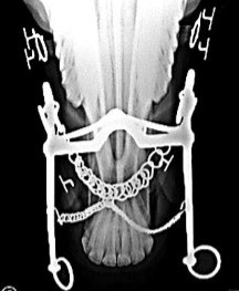 curb bit x-ray in mouth